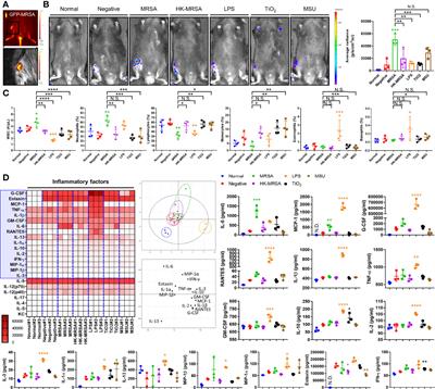 Treating ‘Septic’ With Enhanced Antibiotics and ‘Arthritis’ by Mitigation of Excessive Inflammation